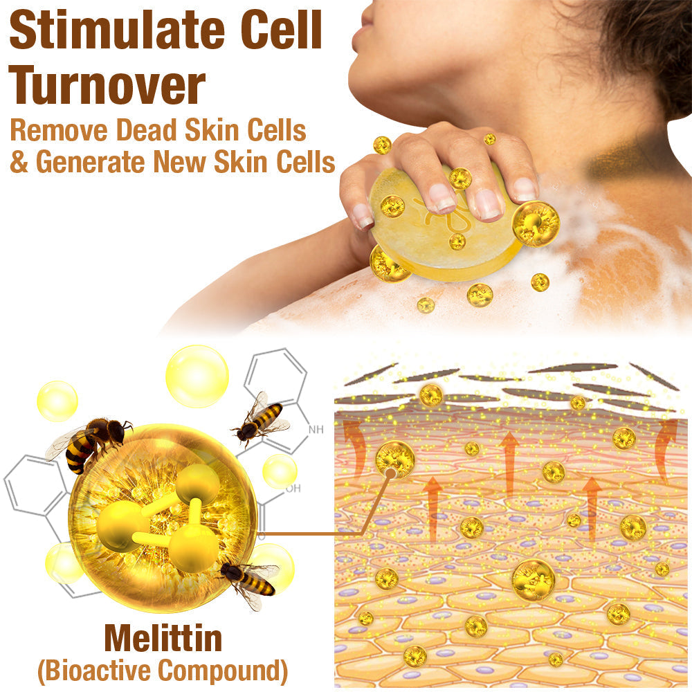 GFOUK™ ShineLuster Acanthosis Nigricans Bee Venom Soap