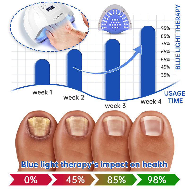 ⭐️Furzero™ Pure Nail Fungus Laser Therapy Device