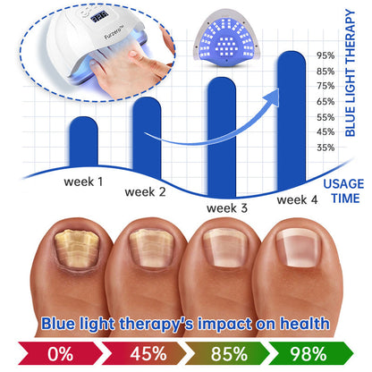 ⭐️Furzero™ Pure Nail Fungus Laser Therapy Device