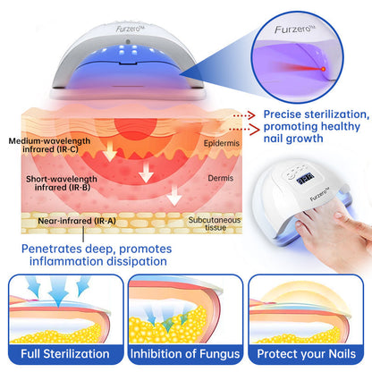 ⭐️⭐️⭐️Furzero™ Pure Nail Fungus Laser Therapy Device