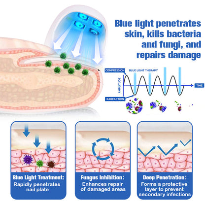 Furzero™ Nail Fungus Cleaning Laser Relief Device
