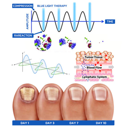 Furzero™ Nail Fungus Cleaning Laser Relief Device