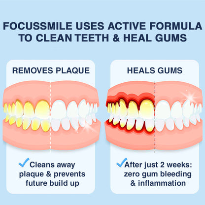 Official Store🥇Furzero™ Focussmile Bee Venom Treatment Oral Powder 🦷 (🇺🇸 FDA-Certified) (Treats periodontitis and mouth ulcers, prevents loose tooth & bleeding gums, and repairs gum recession)