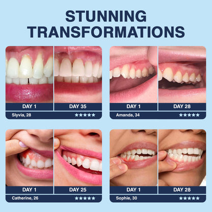 Official Store🥇Furzero™ Focussmile Bee Venom Treatment Oral Powder 🦷 (🇺🇸 FDA-Certified) (Treats periodontitis and mouth ulcers, prevents loose tooth & bleeding gums, and repairs gum recession)