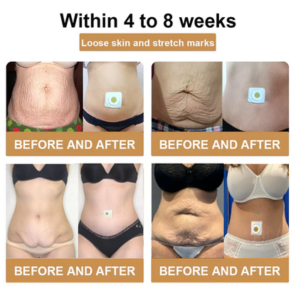 GFOUK™ Bee Venom Lymphatic Drainage Slimming Patch 🔥Limited time 70% OFF🔥