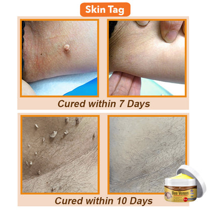 ✨🐝 flysmus™ Bee Venom Comprehensive Cream 🇺🇸 America Dermatologist Recommended