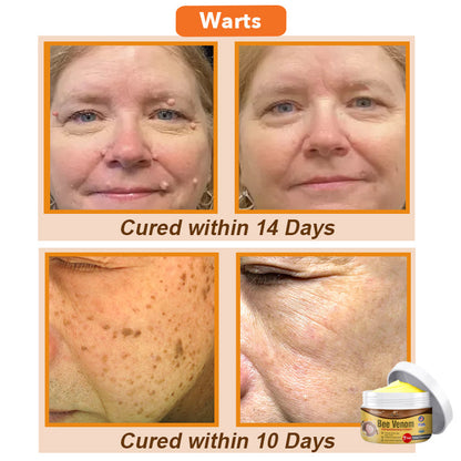 ✨🐝 flysmus™ Bee Venom Comprehensive Cream 🇺🇸 America Dermatologist Recommended